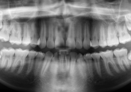 Dental X-Ray Yorba Linda